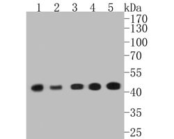 Invitrogen Alpha-Smooth Muscle Actin Recombinant Rabbit Monoclonal Antibody (SY02-64) 100 &mu;L | Buy Online | Invitrogen&trade; | Fisher Scientific