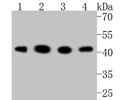 Invitrogen GSK3B Recombinant Rabbit Monoclonal Antibody (SY28-03) 100 &mu;L;