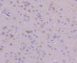 Invitrogen VPS34 Recombinant Rabbit Monoclonal Antibody (SY0286) 100 &mu;L | Buy Online | Invitrogen&trade; | Fisher Scientific