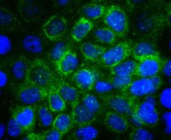 Invitrogen E-cadherin Recombinant Rabbit Monoclonal Antibody (SY0287) 100