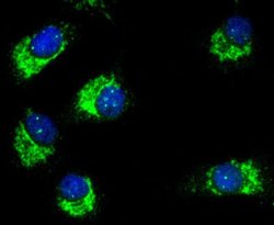 Invitrogen E-cadherin Recombinant Rabbit Monoclonal Antibody (SY0287) 100