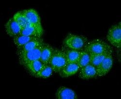 Invitrogen E-cadherin Recombinant Rabbit Monoclonal Antibody (SY0287) 100