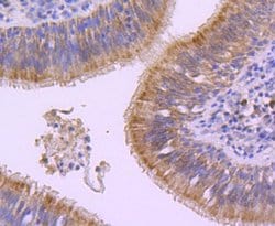 Invitrogen E-cadherin Recombinant Rabbit Monoclonal Antibody (SY0287) 100