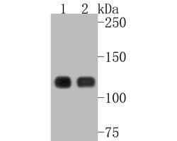 Invitrogen E-cadherin Recombinant Rabbit Monoclonal Antibody (SY0287) 100