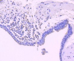 Invitrogen Bim Recombinant Rabbit Monoclonal Antibody (SU0318) 100 &mu;L;