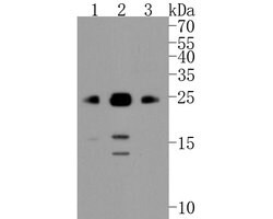 Invitrogen Bim Recombinant Rabbit Monoclonal Antibody (SU0318) 100 &mu;L;
