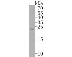 Invitrogen Bim Recombinant Rabbit Monoclonal Antibody (SU0318) 100 &mu;L;