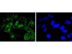 Invitrogen PARP1 Recombinant Rabbit Monoclonal Antibody (SU03-68) 100 &mu;L;
