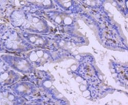 Invitrogen PARP1 Recombinant Rabbit Monoclonal Antibody (SU03-68) 100 &mu;L;