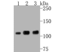 Invitrogen PARP1 Recombinant Rabbit Monoclonal Antibody (SU03-68) 100 &mu;L;