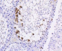 Invitrogen Phospho-Histone H3 (Ser10) Recombinant Rabbit Monoclonal Antibody