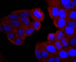 Invitrogen PI3K p85 alpha Recombinant Rabbit Monoclonal Antibody (SU04-07)