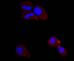 Invitrogen PI3K p85 alpha Recombinant Rabbit Monoclonal Antibody (SU04-07)