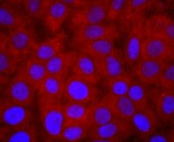 Invitrogen PI3K p85 alpha Recombinant Rabbit Monoclonal Antibody (SU04-07)