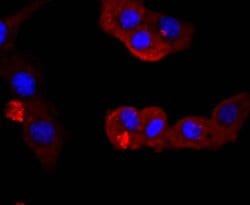 Invitrogen PI3K p85 alpha Recombinant Rabbit Monoclonal Antibody (SU04-07)