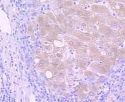 Invitrogen PI3K p85 alpha Recombinant Rabbit Monoclonal Antibody (SU04-07)