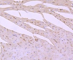 Invitrogen PI3K p85 alpha Recombinant Rabbit Monoclonal Antibody (SU04-07)
