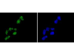 Invitrogen Histone H2A.Z Recombinant Rabbit Monoclonal Antibody (ST46-09)