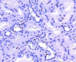 Invitrogen Histone H2A.Z Recombinant Rabbit Monoclonal Antibody (ST46-09)