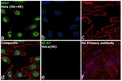 Invitrogen Ki-67 Recombinant Rabbit Monoclonal Antibody (ST50-01) 100 &mu;L;