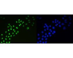 Invitrogen Ki-67 Recombinant Rabbit Monoclonal Antibody (ST50-01) 100 &mu;L;