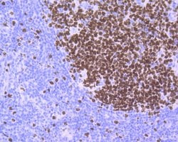 Invitrogen Ki-67 Recombinant Rabbit Monoclonal Antibody (ST50-01) 100 &mu;L;