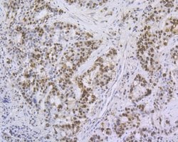 Invitrogen Ki-67 Recombinant Rabbit Monoclonal Antibody (ST50-01) 100 &mu;L;
