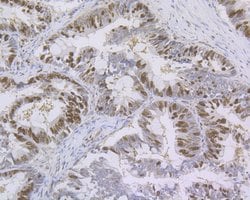 Invitrogen Ki-67 Recombinant Rabbit Monoclonal Antibody (ST50-01) 100 &mu;L;