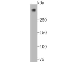 Invitrogen Ki-67 Recombinant Rabbit Monoclonal Antibody (ST50-01) 100 &mu;L;