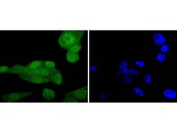 Invitrogen Phospho-AKT1 (Ser124) Recombinant Rabbit Monoclonal Antibody