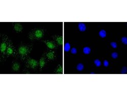 Invitrogen Phospho-AKT1 (Ser124) Recombinant Rabbit Monoclonal Antibody