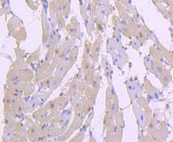 Invitrogen Phospho-AKT1 (Ser124) Recombinant Rabbit Monoclonal Antibody