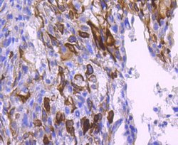 Invitrogen Phospho-AKT1 (Ser124) Recombinant Rabbit Monoclonal Antibody