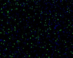 Invitrogen AKT1 Recombinant Rabbit Monoclonal Antibody (ST05-09) 100 &mu;L | Buy Online | Invitrogen&trade; | Fisher Scientific