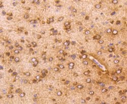 Invitrogen AKT1 Recombinant Rabbit Monoclonal Antibody (ST05-09) 100 &mu;L | Buy Online | Invitrogen&trade; | Fisher Scientific