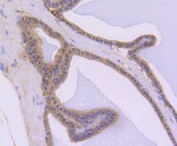 Invitrogen AKT1 Recombinant Rabbit Monoclonal Antibody (ST05-09) 100 &mu;L | Buy Online | Invitrogen&trade; | Fisher Scientific