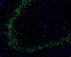 Invitrogen AKT1 Recombinant Rabbit Monoclonal Antibody (ST05-09) 100 &mu;L | Buy Online | Invitrogen&trade; | Fisher Scientific