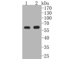 Invitrogen AKT1 Recombinant Rabbit Monoclonal Antibody (ST05-09) 100 &mu;L | Buy Online | Invitrogen&trade; | Fisher Scientific