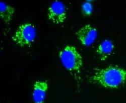 Invitrogen AKT Pan Recombinant Rabbit Monoclonal Antibody (ST48-09) 100