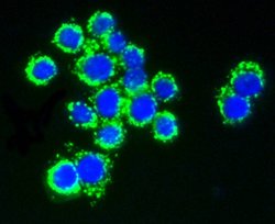 Invitrogen AKT Pan Recombinant Rabbit Monoclonal Antibody (ST48-09) 100