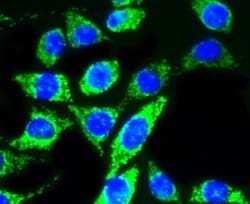 Invitrogen AKT Pan Recombinant Rabbit Monoclonal Antibody (ST48-09) 100