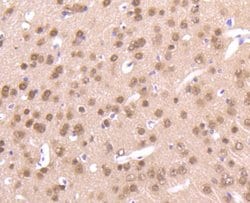 Invitrogen AKT Pan Recombinant Rabbit Monoclonal Antibody (ST48-09) 100