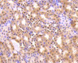 Invitrogen AKT Pan Recombinant Rabbit Monoclonal Antibody (ST48-09) 100