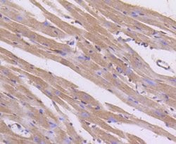 Invitrogen AKT Pan Recombinant Rabbit Monoclonal Antibody (ST48-09) 100