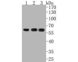 Invitrogen AKT Pan Recombinant Rabbit Monoclonal Antibody (ST48-09) 100