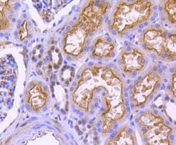 Invitrogen Phospho-YAP1 (Ser127) Recombinant Rabbit Monoclonal Antibody