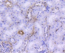 Invitrogen Phospho-YAP1 (Ser127) Recombinant Rabbit Monoclonal Antibody