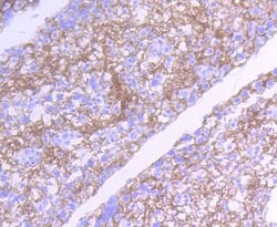 Invitrogen SRC Recombinant Rabbit Monoclonal Antibody (ST05-03) 100 &mu;L;