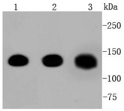 Invitrogen Pan-cadherin Recombinant Rabbit Monoclonal Antibody (ST54-01)