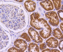 Invitrogen SGK1 Recombinant Rabbit Monoclonal Antibody (SC05-71) 100 &mu;L;